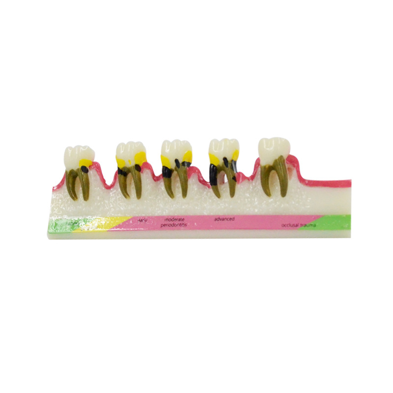 Periodontal Disease Model Dent - Medical Lab Study review and price